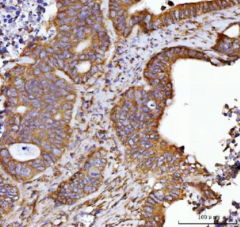 Septin 2/SEPTIN2 Antibody