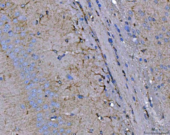 Septin 2/SEPTIN2 Antibody