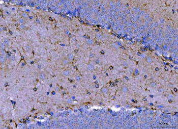 Septin 2/SEPTIN2 Antibody