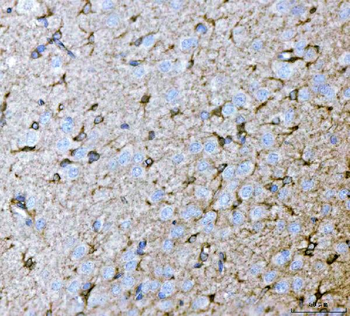 Septin 2/SEPTIN2 Antibody