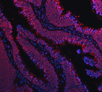 TIP49A/RUVBL1 Antibody