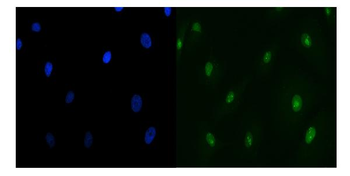 TIP49A/RUVBL1 Antibody