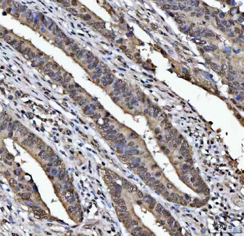 TIP49A/RUVBL1 Antibody