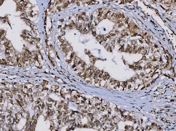 TIP49A/RUVBL1 Antibody