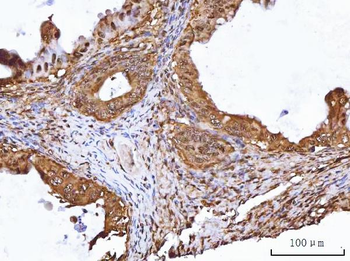 TIP49A/RUVBL1 Antibody