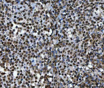 TIP49A/RUVBL1 Antibody