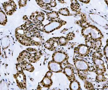 TIP49A/RUVBL1 Antibody