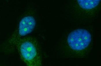 RRS1 Antibody