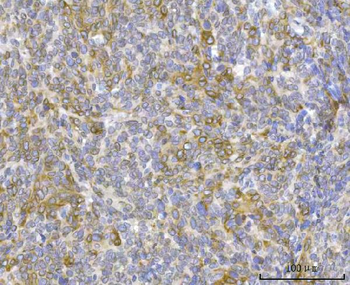 RRS1 Antibody