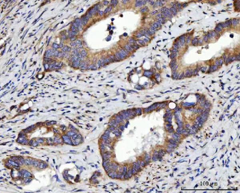 RRS1 Antibody