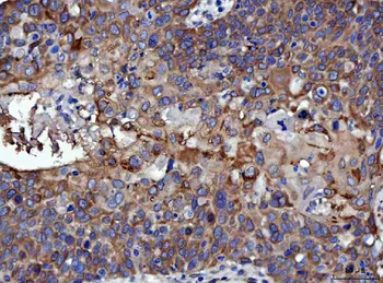 RRS1 Antibody