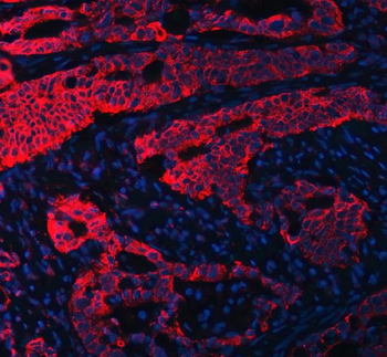 RPL36 Antibody