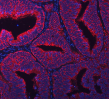 RPL36 Antibody