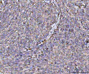 RPL36 Antibody