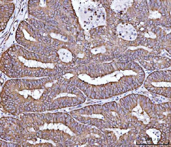 RPL36 Antibody