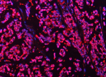 PSMB4 Antibody