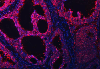 PSMB4 Antibody