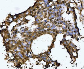 PSMB4 Antibody