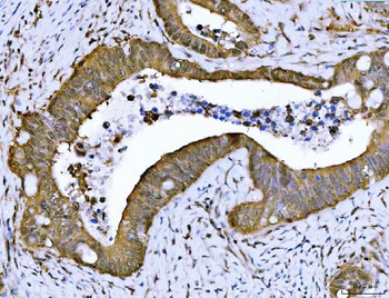PSMB4 Antibody