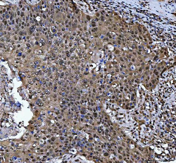 PSMB4 Antibody