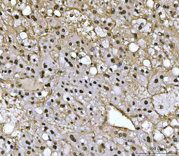 PSMB4 Antibody