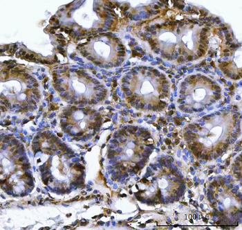 PSMB4 Antibody