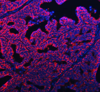 APP-1/PABPC4 Antibody