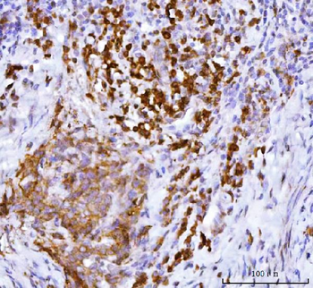 APP-1/PABPC4 Antibody