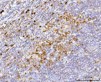 APP-1/PABPC4 Antibody