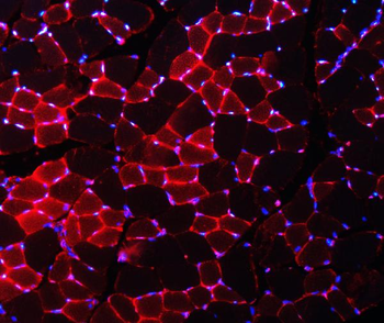 Nedd4 Rabbit Polyclonal Antibody