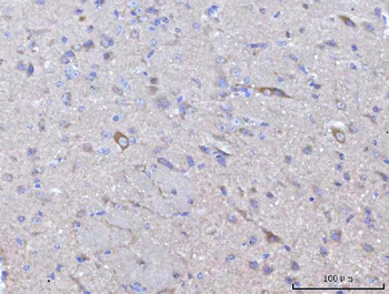 Nedd4 Rabbit Polyclonal Antibody