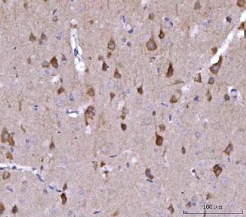 Nedd4 Rabbit Polyclonal Antibody