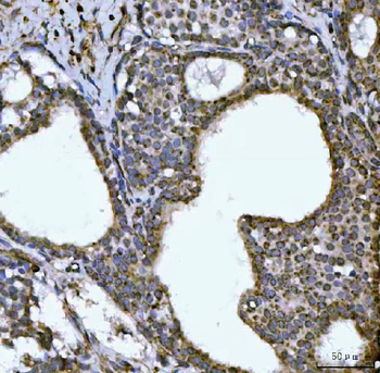 NDUFS6 Rabbit Polyclonal Antibody