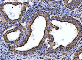 NDUFS6 Rabbit Polyclonal Antibody