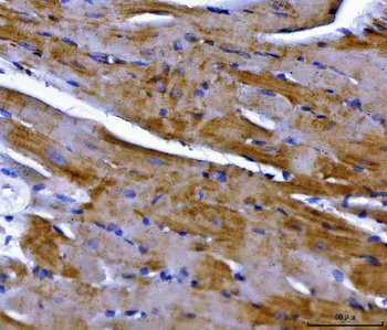 NDUFS2 Antibody