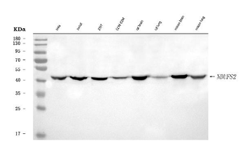 NDUFS2 Antibody