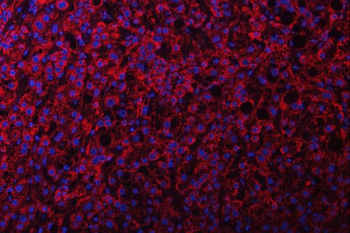 NDUFS2 Antibody