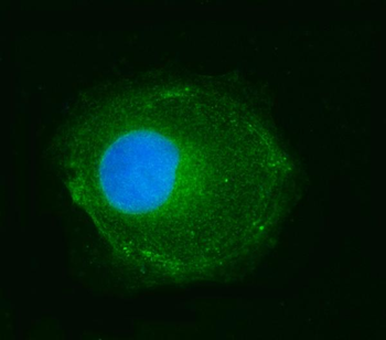 NDUFS2 Antibody