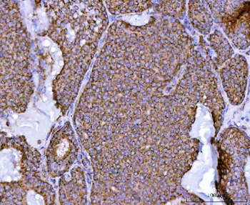 NDUFS2 Antibody