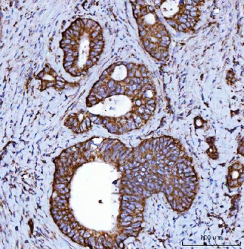 NDUFS2 Antibody