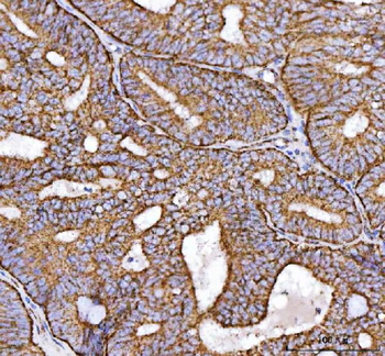 NDUFS2 Antibody