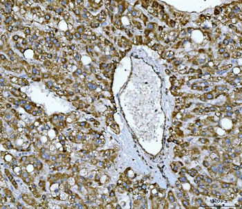 NDUFS2 Antibody