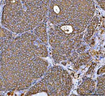 MRPS22 Antibody