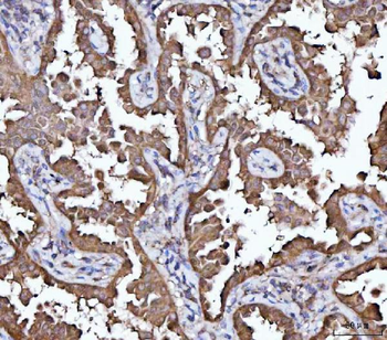MRPS22 Antibody