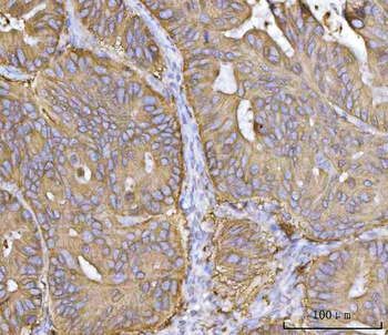 MRPS22 Antibody