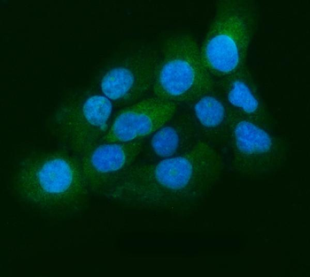 Eg5/KIF11 Rabbit Polyclonal Antibody