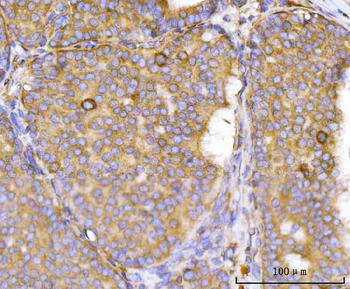Eg5/KIF11 Rabbit Polyclonal Antibody