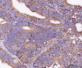 Eg5/KIF11 Rabbit Polyclonal Antibody