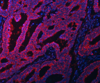 EIF3A Rabbit Polyclonal Antibody