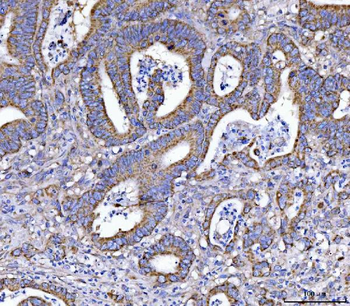 EIF3A Rabbit Polyclonal Antibody
